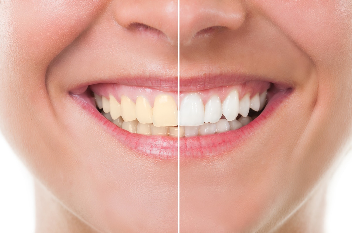 Best Cosmetic Dentistry